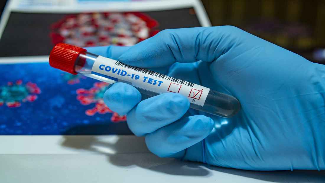 ΠΟΕΔΗΝ: Τα δημόσια νοσοκομεία αγοράζουν PCR τεστ στη μισή τιμή από τα 47 ευρώ που όρισε το υπουργείο