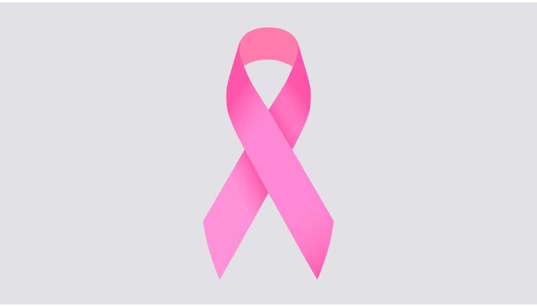 Υπόμνημα για την αντιμετώπιση και διαχείριση του καρκίνου του μαστού στην Ελλάδα